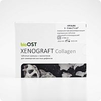 XENOGRAFT Collagen | 1.0 - 2.0 |